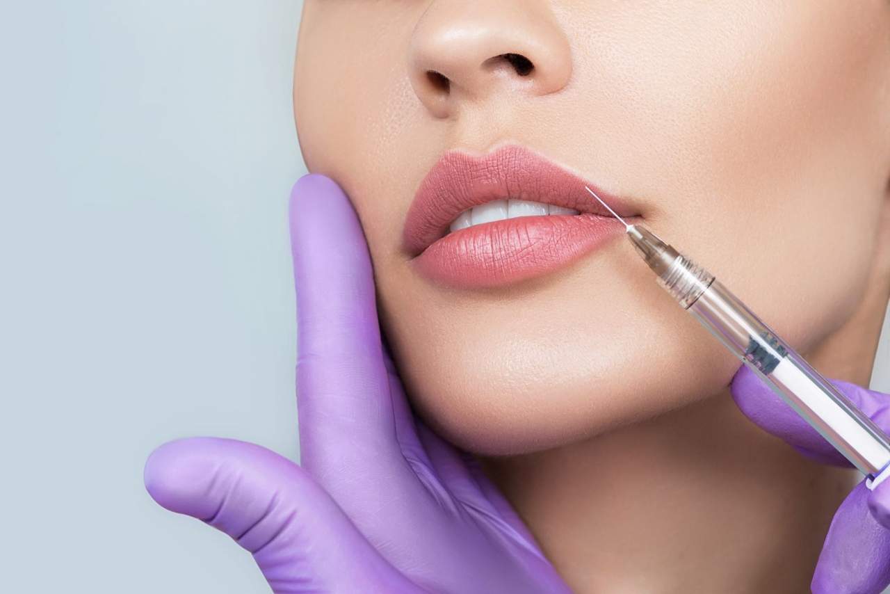 Aumento de labios en A Coruña por Dra. Alfonsina Uriburu
